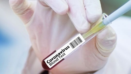 Drugi przypadek koronawirusa w Bełchatowie?